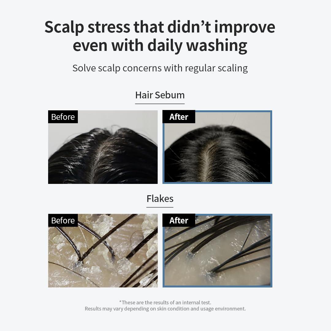 GROWUS Sea Salt Therapy Scalp Scaler 120g 4