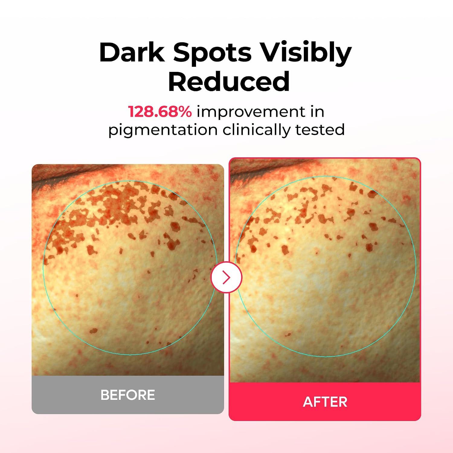 Dr.Melaxin TX-ASTAXANTHIN DARK SPOT CARE CREAM HYDEOGEL MASK 2g+34g*4ea 3