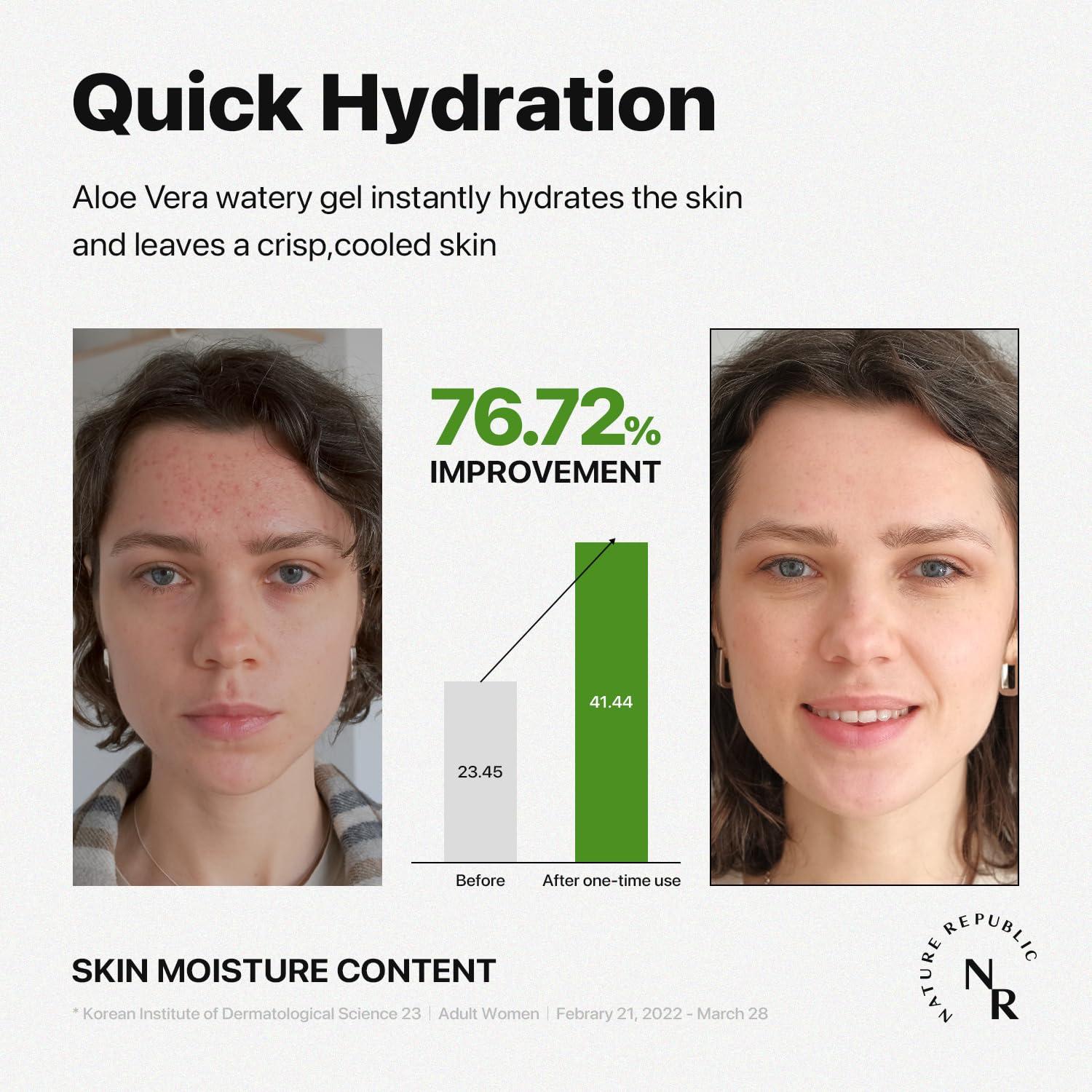 Nature Republic MILD & MOISTURE ALOE VERA WATERY GEL 5