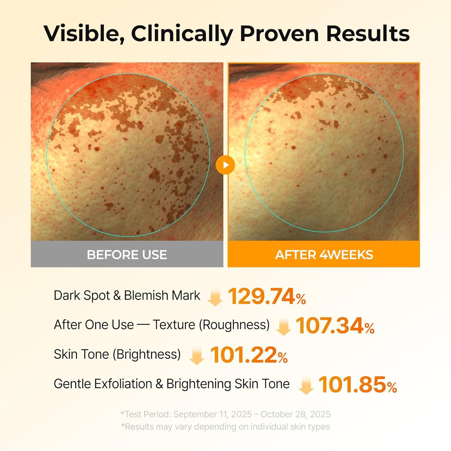 Dr.Melaxin TX-KOJIC ACID TURMERIC TONER PAD 70ea 3