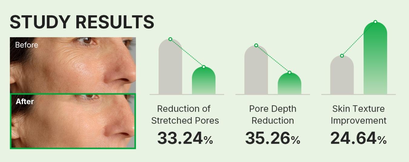 Sungboon Editor Green Tomato Spicule Pore Boosting Ampoule 30ml 7