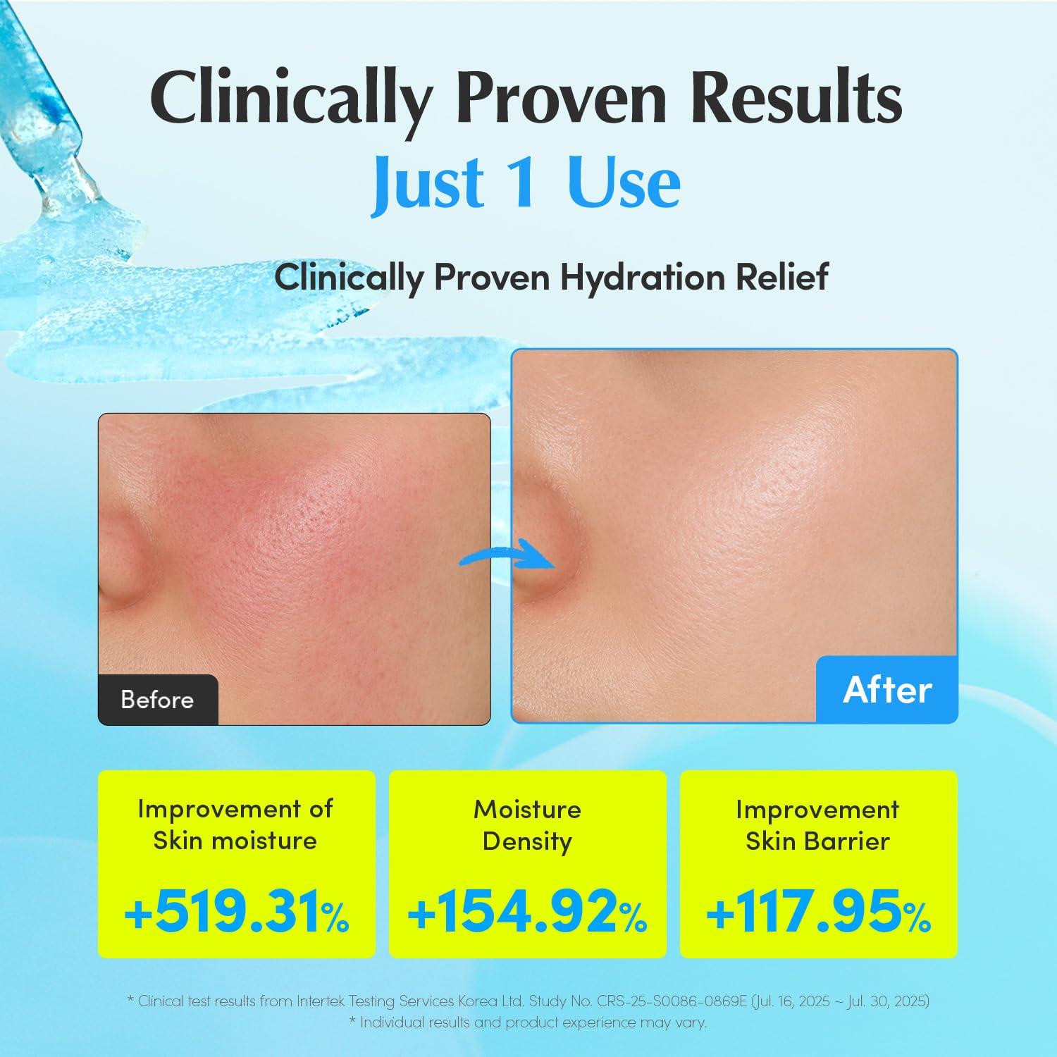 EQQUALBERRY HYALTOIN FLOODING SERUM 30ml/HYALTOIN 4