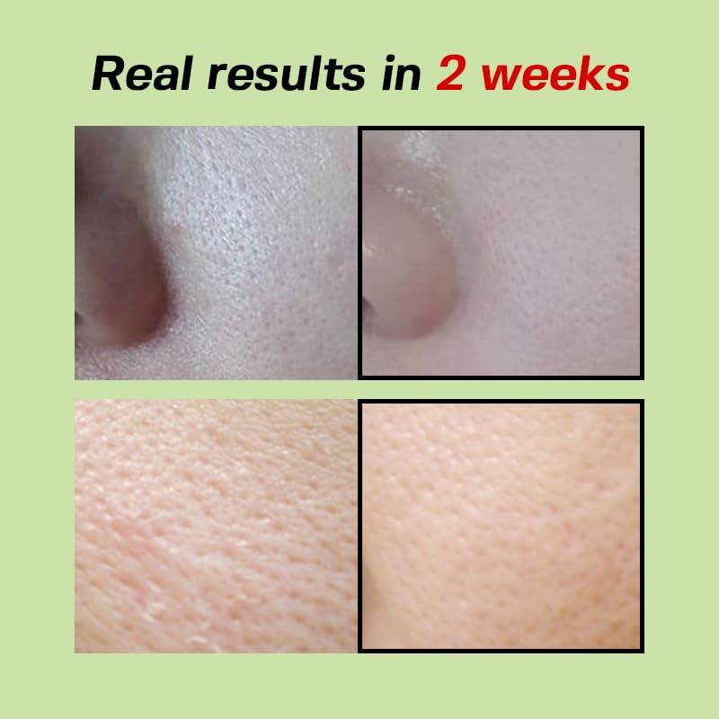 Sungboon Editor Green Tomato Pore minimizing Ampoule+ 30ml (Renewed).jpg 6