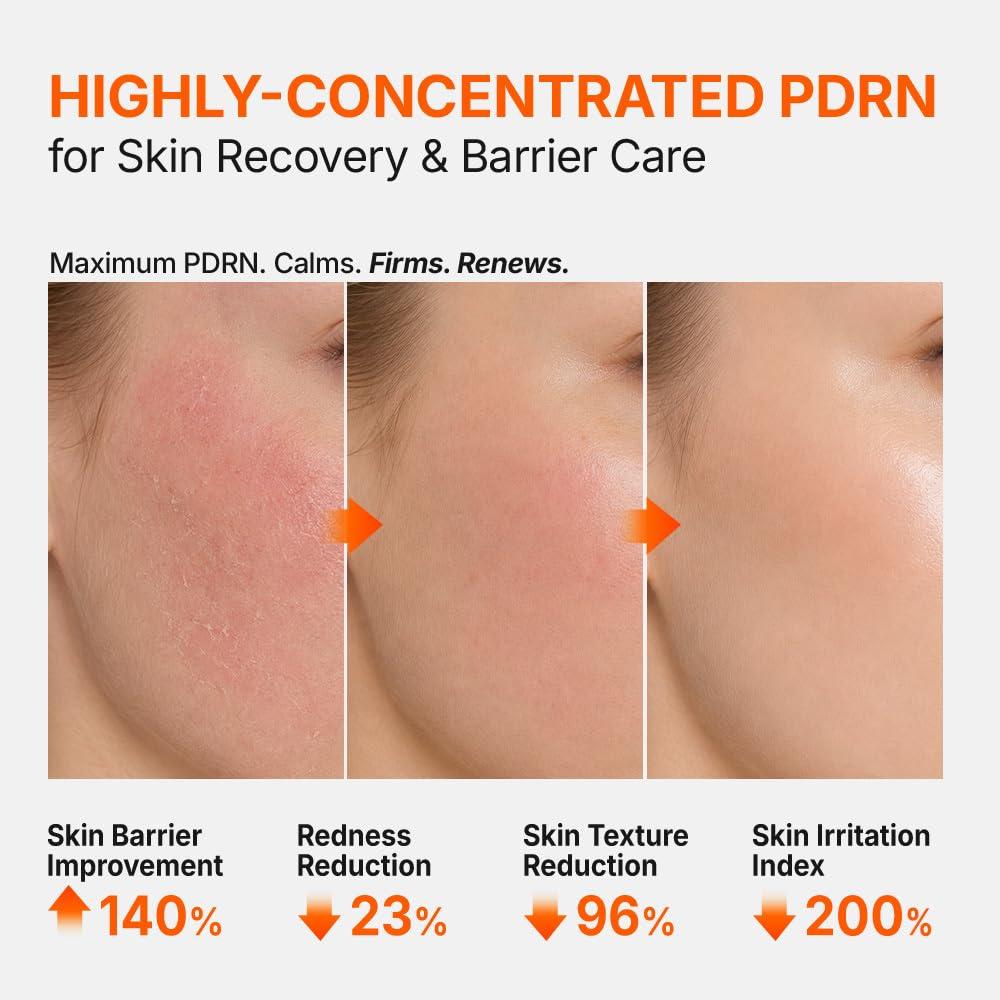 Genabelle PDRN 3% Hyper Boost Ampoule 40ml 5