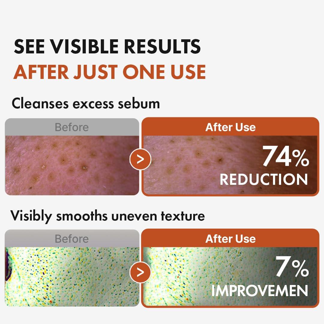 Hanskin Pore Cleansing Oil BHA 300ml 3