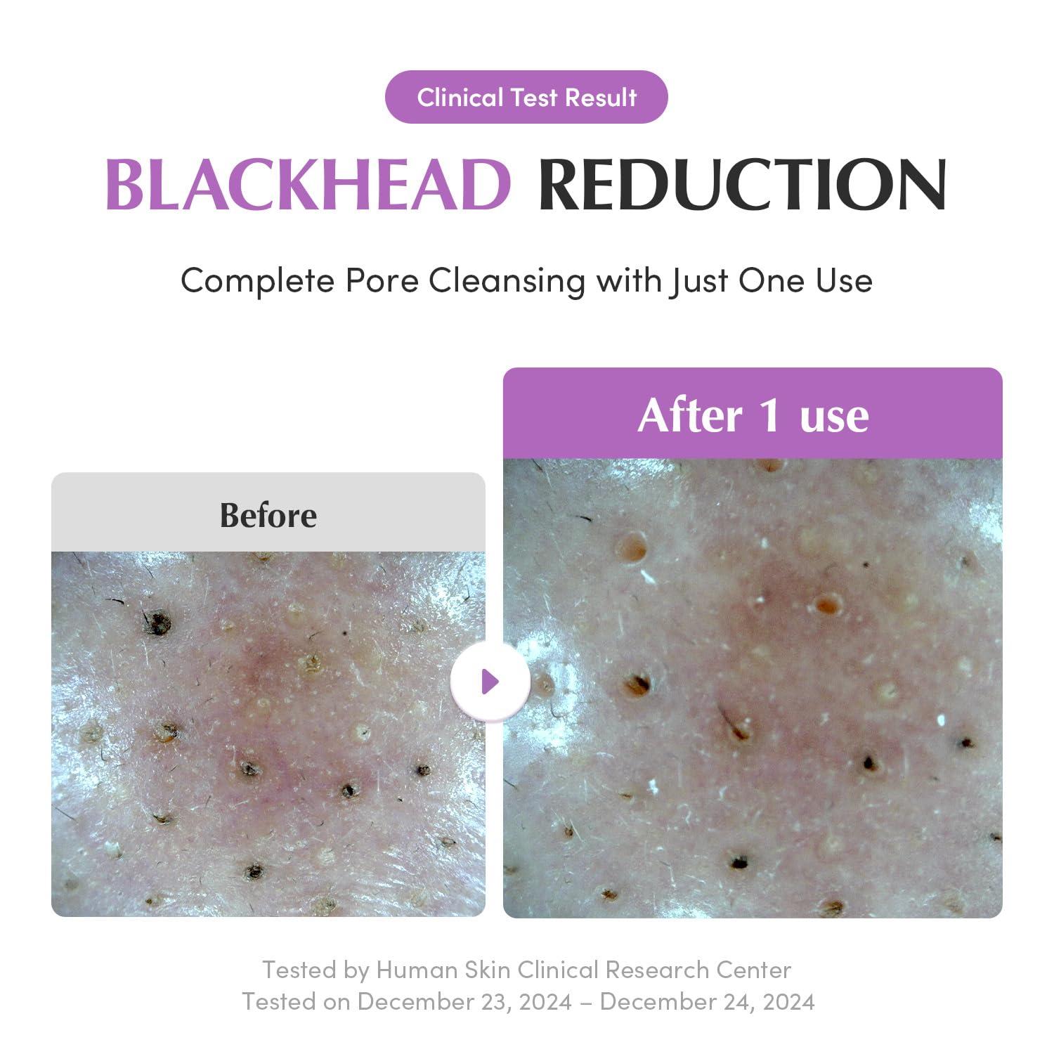 EQQUALBERRY Purple Rice Pore Purifying Pack Cleanser 130g 5
