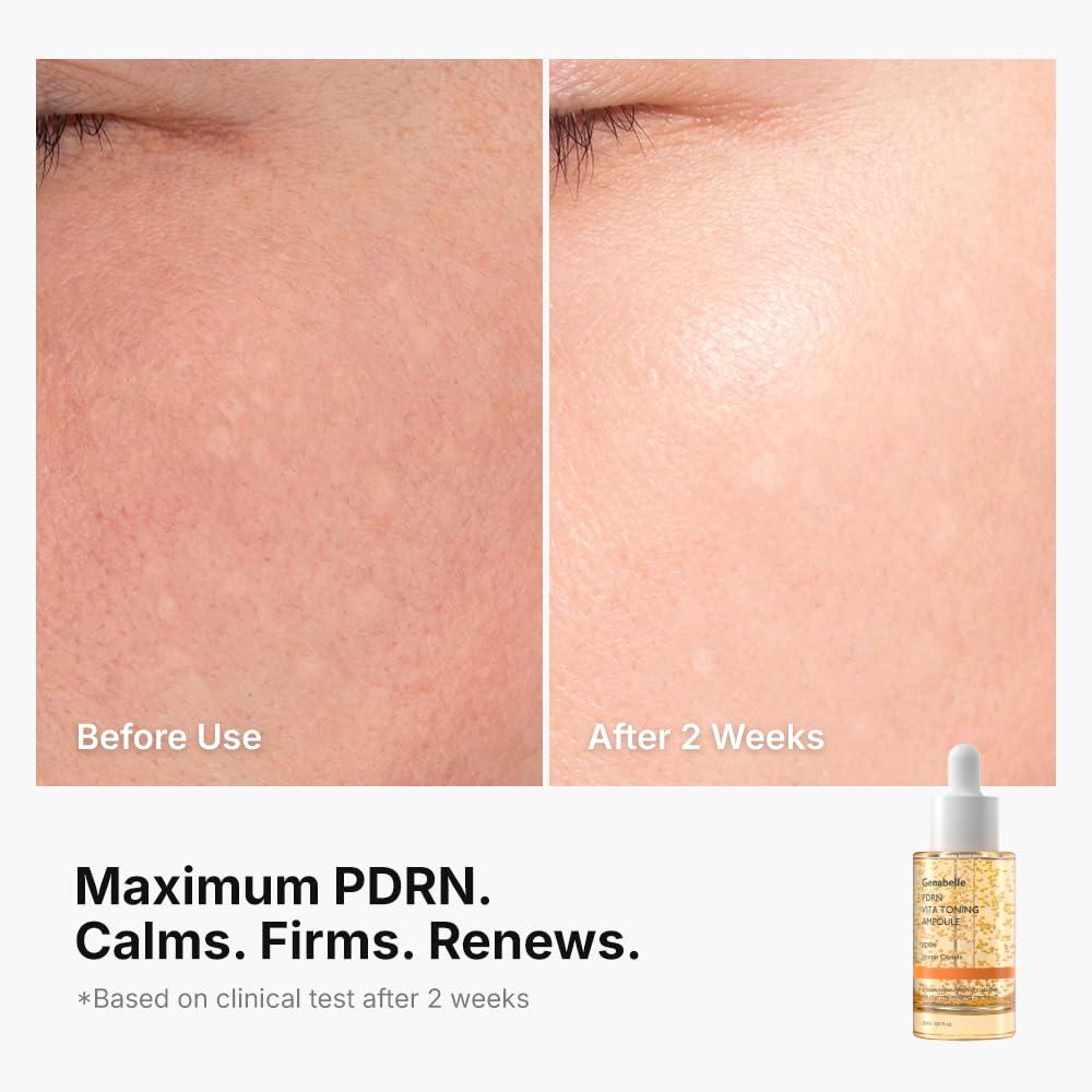 Genabelle PDRN VITA Toning Ampoule 30ml 5